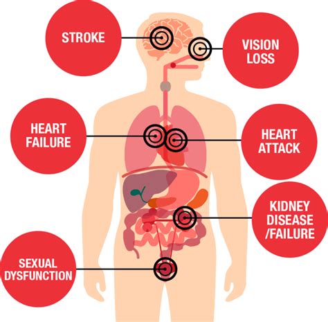 Can Common Viruses Like COVID-19 Lead to High Blood Pressure?