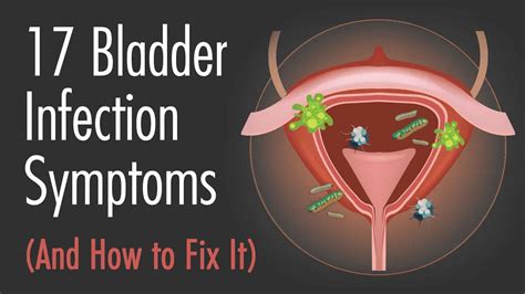 How Can You Manage Recurring Bladder Infections Effectively?