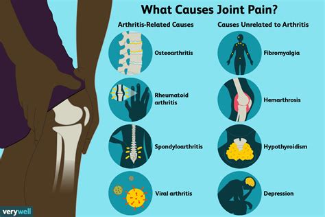 Joint Pain Illustration