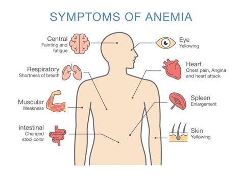 Understanding Anemia: Causes, Symptoms, and Treatments