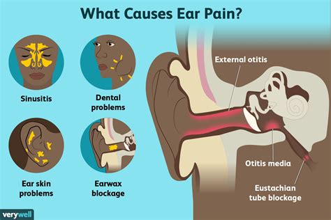 Understanding Ear Infections: Causes, Symptoms, and Treatments