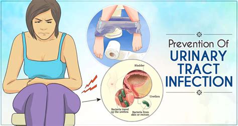 Understanding Recurrent Urinary Tract Infections: Causes and Prevention