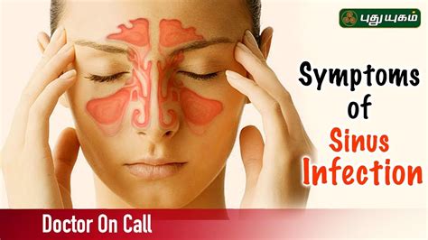 Understanding Sinusitis: Symptoms, Causes, and Treatments