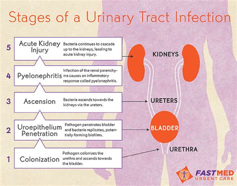 Understanding the Pathophysiology of Urinary Tract Infections