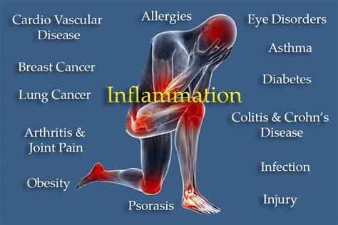 What Is Inflammation and How Can You Reduce It?