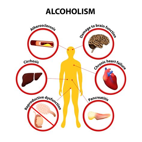 How Does Alcohol Affect Inflammation and the Body's Immune Response?