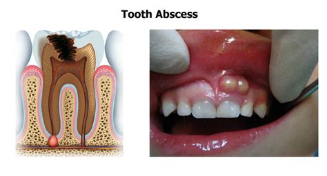 Hidden Dental Dangers and Overall Health