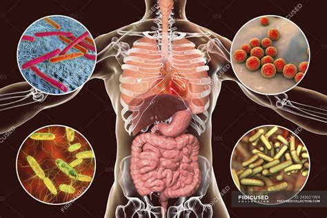 Understanding Bacterial and Viral Infections