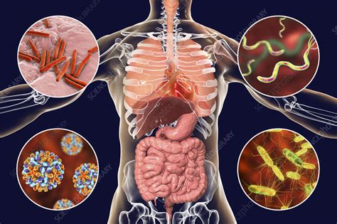 Understanding Bacterial Diseases in Humans