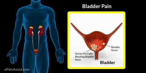 Understanding Bladder and Kidney Health: Symptoms, Causes, and Treatments