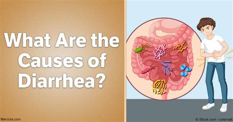 Understanding Diarrhea: Causes, Symptoms, and Treatments