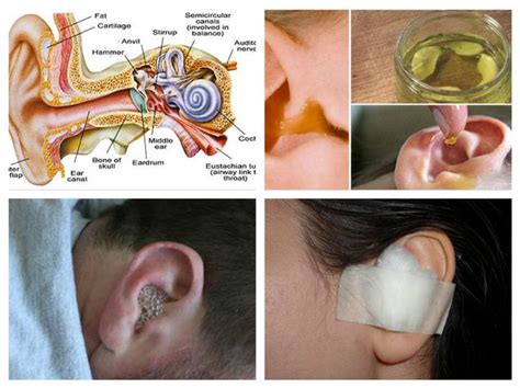 Understanding Ear Infections: Causes, Symptoms, and Treatments