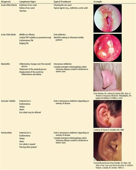 Understanding Ear Infections