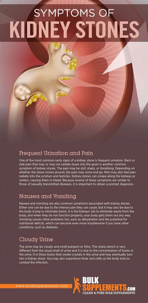 Understanding Kidney Stones