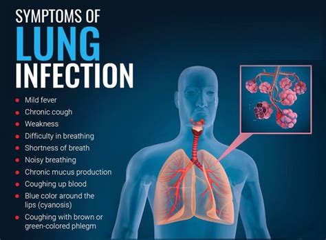 Understanding Pneumonia