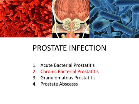 Understanding Prostatitis