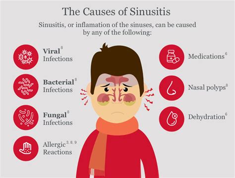 Understanding Sinus Infections: Symptoms, Causes, and Treatment Options