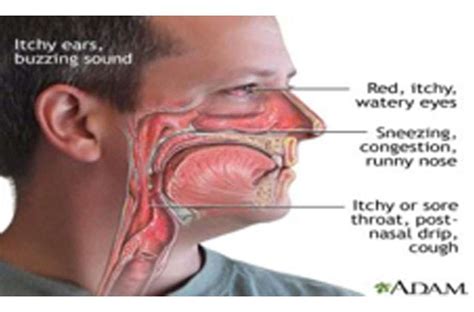 Understanding Sinus Infections: Symptoms, Diagnosis, and Treatments