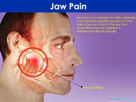 Understanding Sinusitis and Jaw Pain