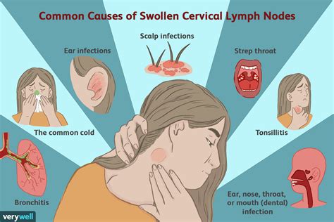 Understanding Sinusitis: Causes, Symptoms, and Treatments