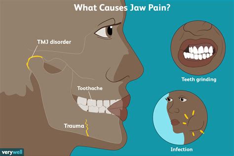 Understanding the Causes of Sudden Jaw Pain