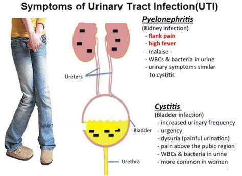 Understanding the Impact of Drugs on Urine Drug Screens and Chronic UTIs