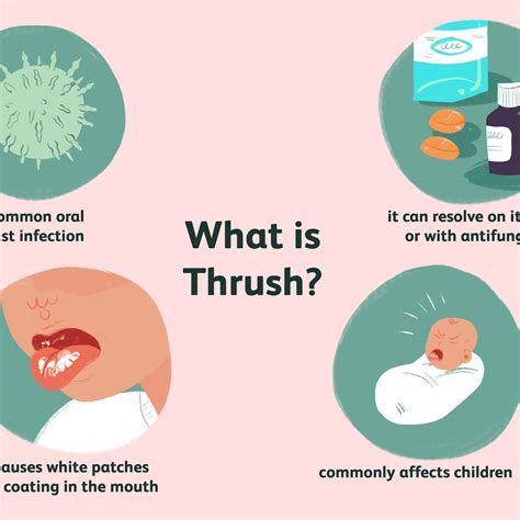 Understanding Thrush and Candidiasis in Children