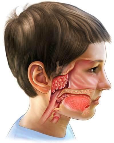 Understanding Tonsils and Adenoids